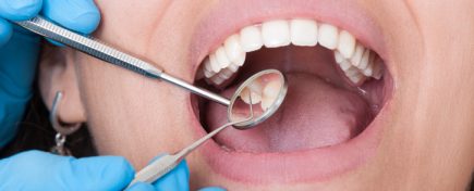 Closeup of dentist tools and mouth open with beautiful teeth