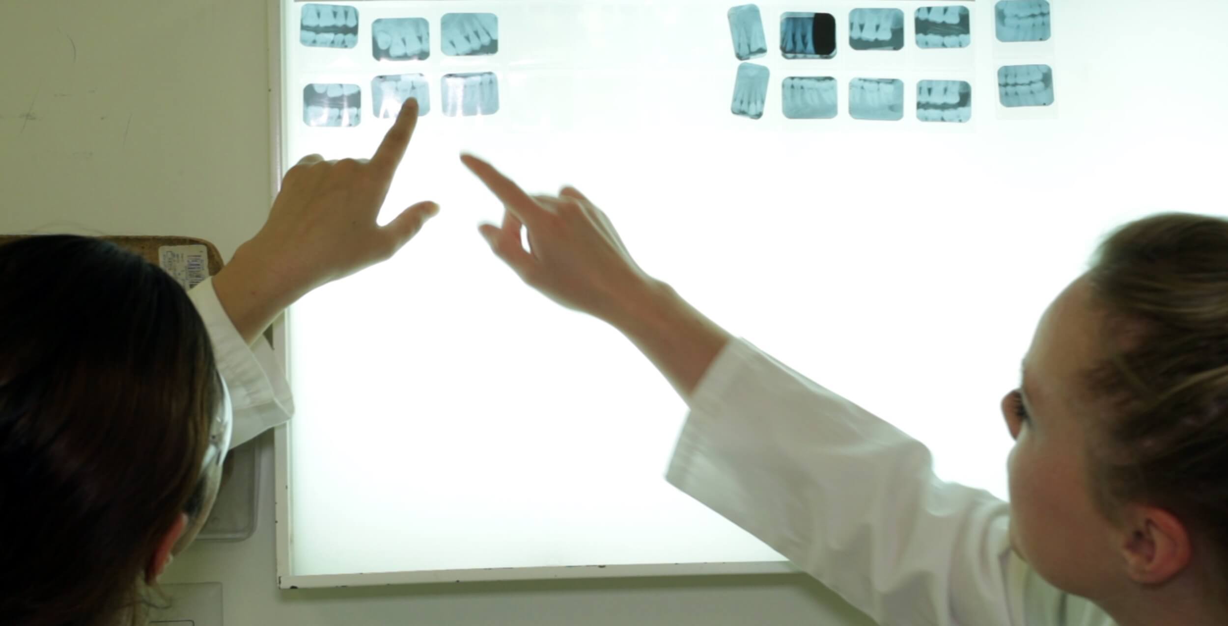 Dental assistant job duties demonstrated by two professionals in white lab coats reviewing and pointing at dental X-rays on an illuminated lightbox.
